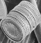Diatom